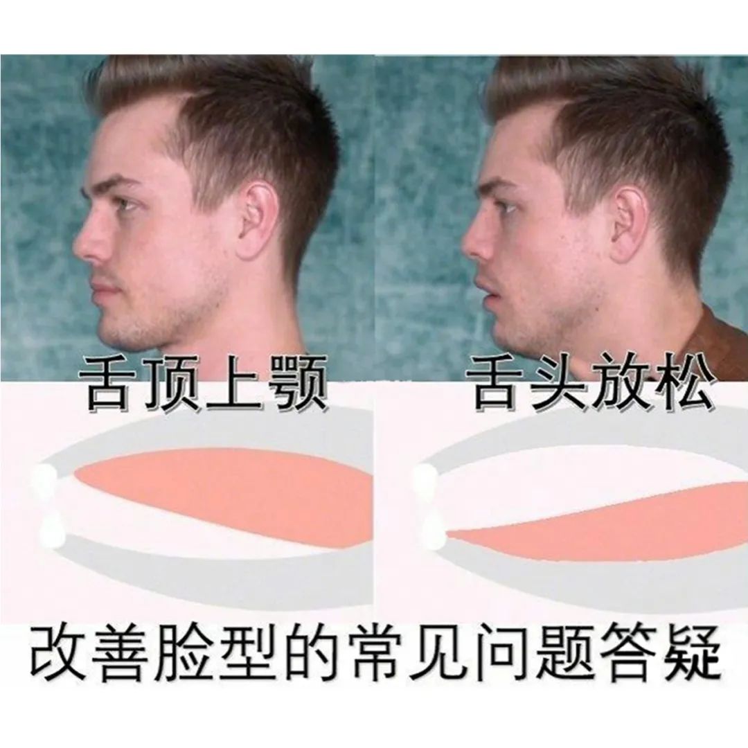 被丑哭了怎么办,被凸嘴拉低颜值怎么改善