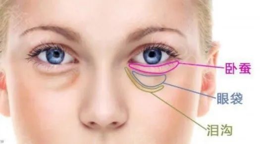 眼睛无神适合什么卧蚕,眼睛小卧蚕的画法