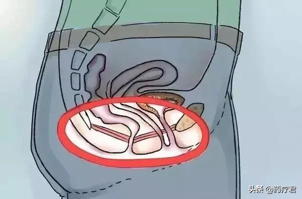 咳嗽打喷嚏大笑都流尿是怎么回事,咳嗽大笑就会漏尿是得了哪种病