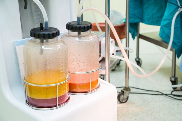 瘦的代价是什么,抽脂代价