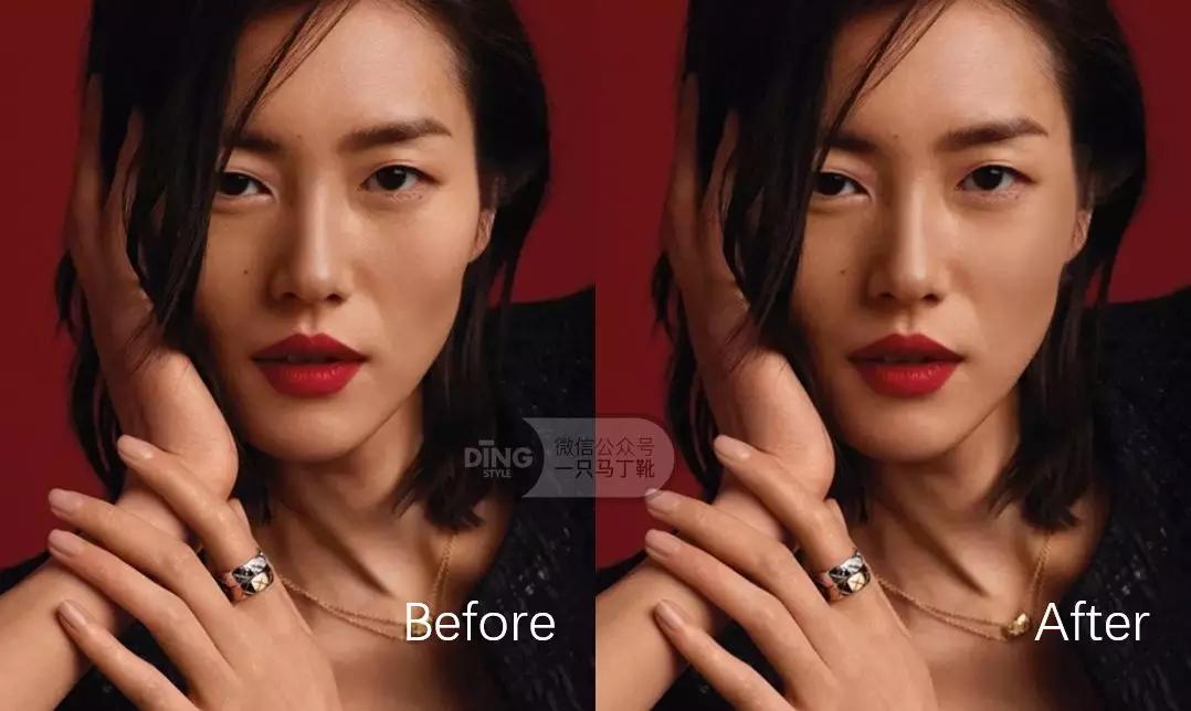 颧弓高脸型怎么改善,有泪沟可以通过调整脸型改善嘛