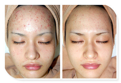 抗氧化是抗老的意思吗,抗氧化抗衰老什么意思