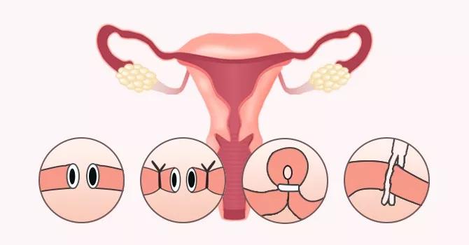南昌华儿山孕育课堂：做完输卵管复通术后多久能怀孕？