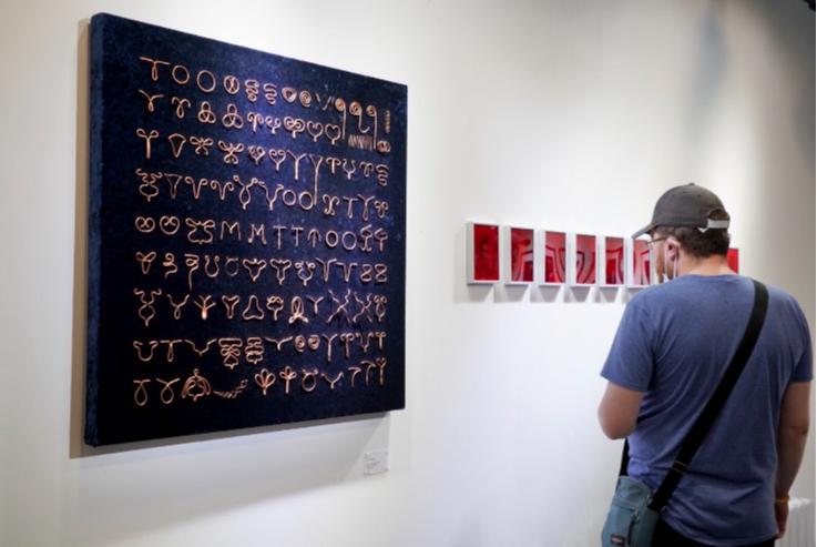 放置了25年的节育环,十年前最好的节育环