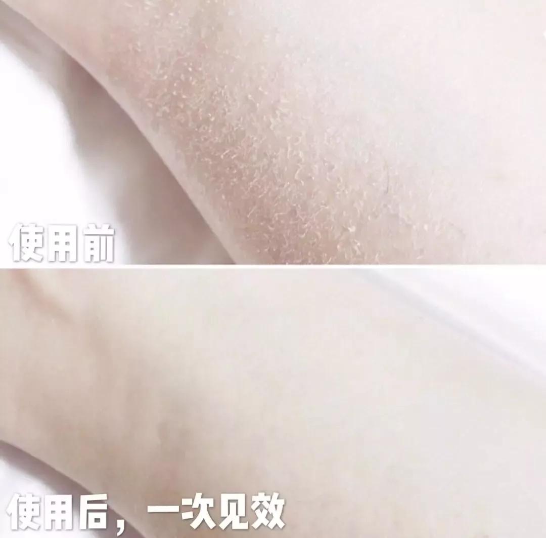 坚持涂身体乳还是很干,坚持涂身体乳二十年