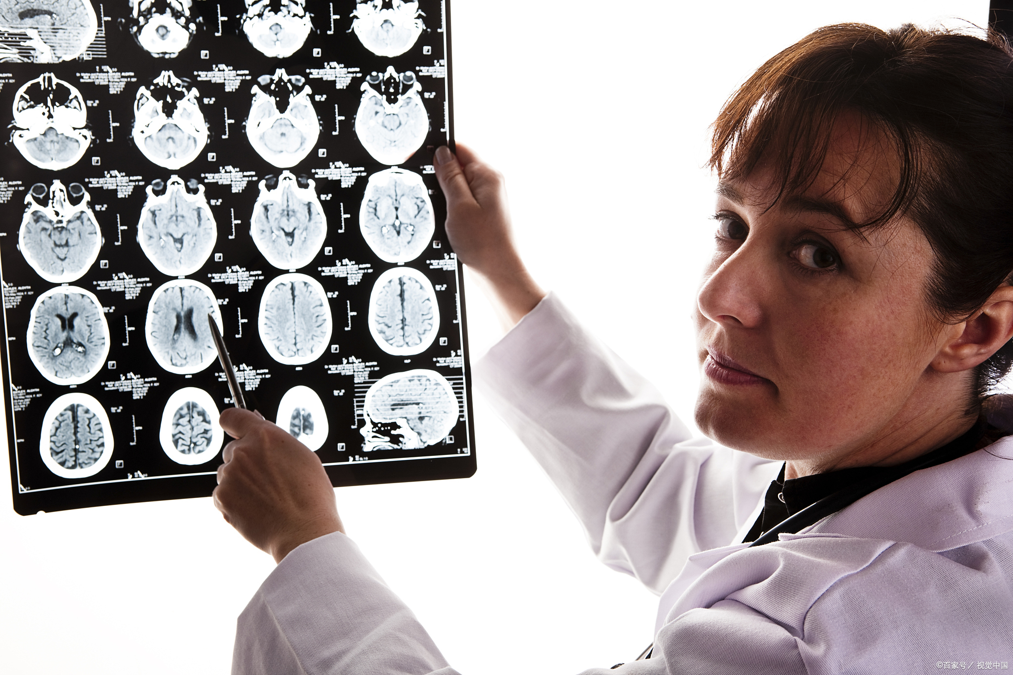 肝硬化发生肝昏迷常见原因,什么是肝硬化早期有哪些症状