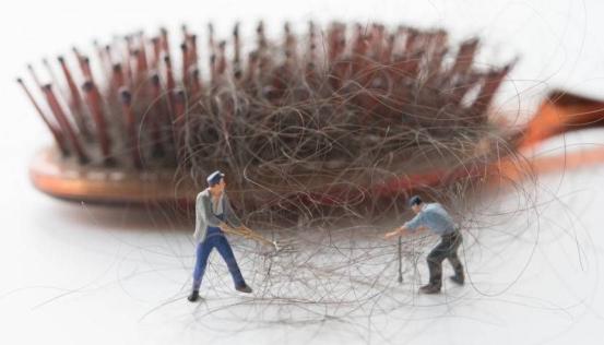 脱发别怕中医教你这两招,脱发经典方子