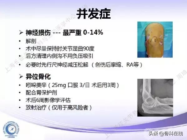 肘关节镜手术后引流,肘关节镜微创手术