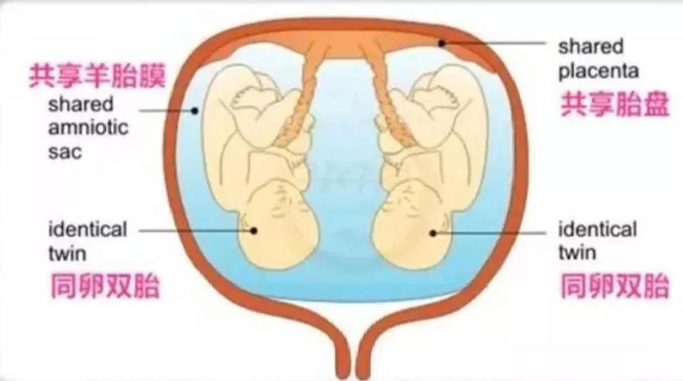 7年怀孕5次后续,7次怀孕4次流产后续