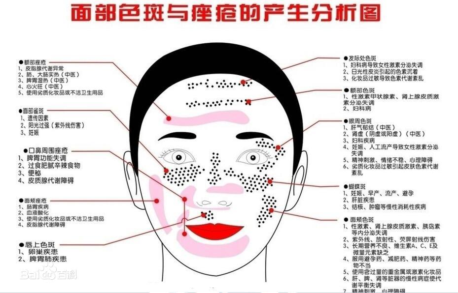 斑的种类及症状,斑形成的主要原因是什么