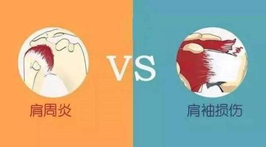 肩肌劳损怎么练肩,肩膀疼痛还能继续练肩嘛