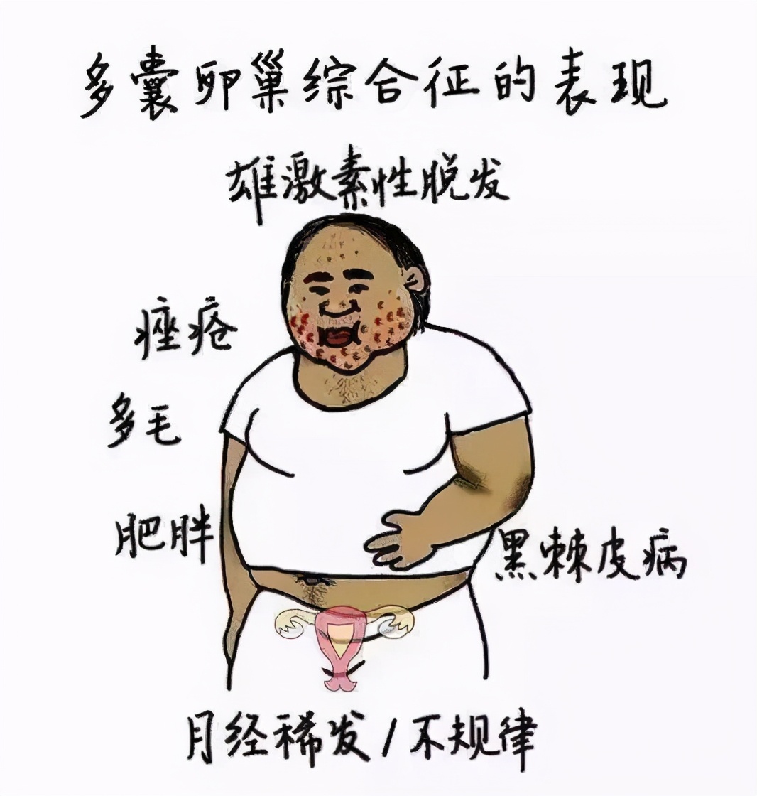 胖多囊怎么减肥备孕,减肥减出多囊卵巢综合症