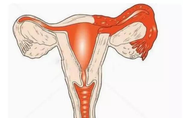 为什么怀个孩子那么难？或许是这几个原因导致的