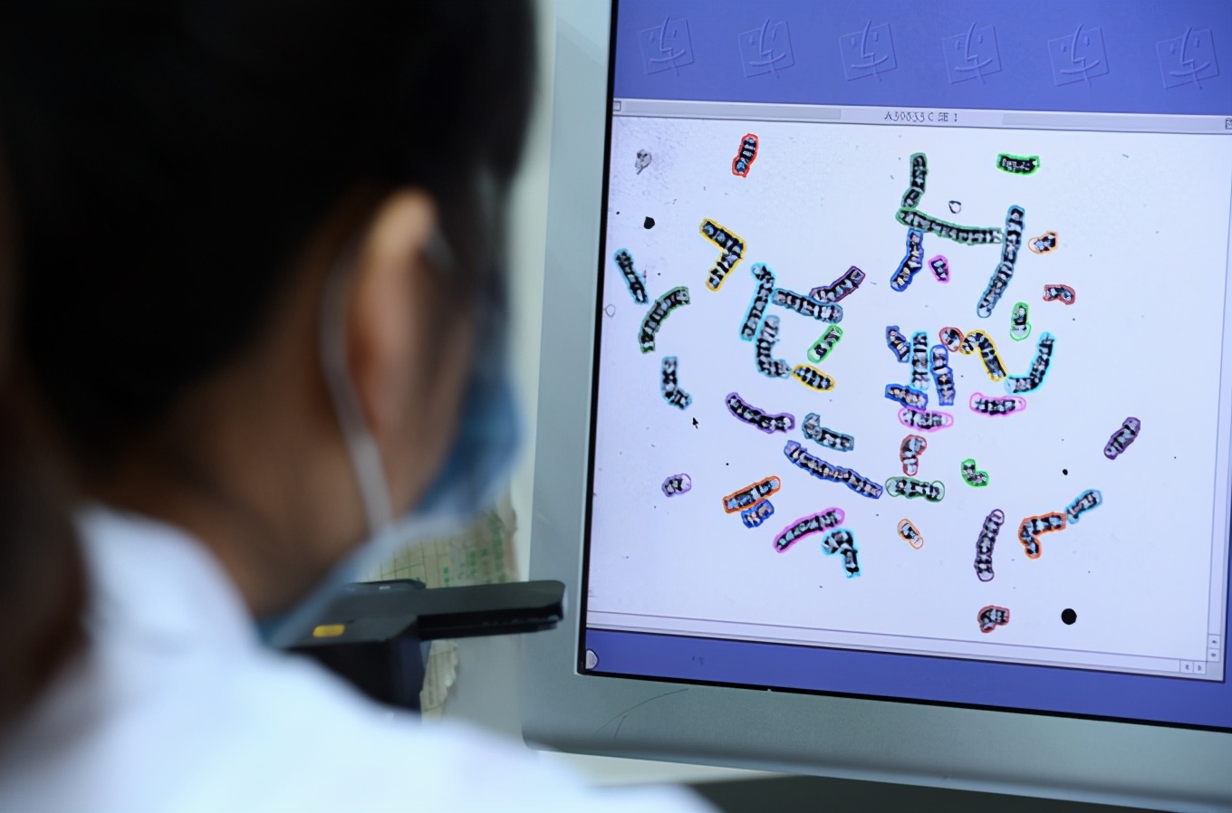 女生崴脚把脚踝扭伤了,25岁已婚姑娘脚扭伤