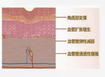 *血丝红**的自救指南，大家快来抄作业