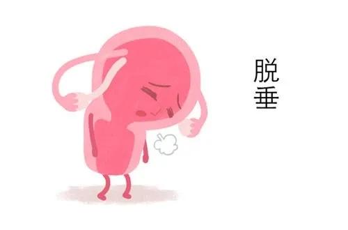 56岁子宫脱垂并伴有出血症状,孕期子宫脱垂的症状及危害