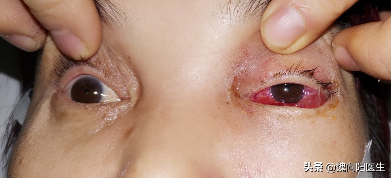 为什么后脑勺怕风,后脑勺着地好不好