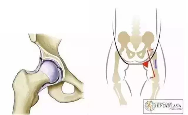 把尿真的有危害吗,把尿会造成什么后果