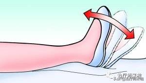 髋关节术后半年康复,髋关节术后早期康复