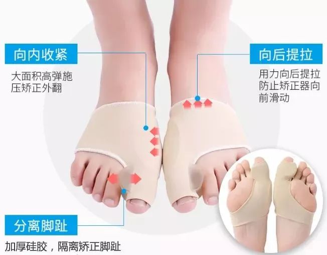 脚趾超级痛,轻度脚趾外翻如何矫正