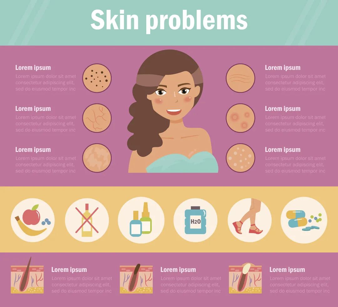 正确有效的祛除痘痘痘印方法,怎样才能彻底根治痘痘痘印