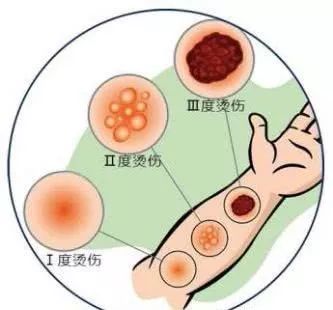 重庆附一院出名的科室有哪些,重庆西南医院擅长哪些科室