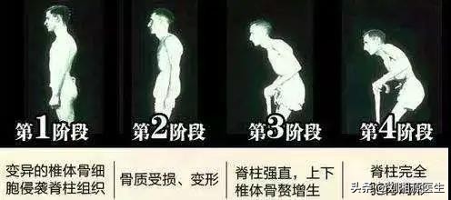 免疫相关不良妊娠诊断指南,免疫治疗不良妊娠的方法