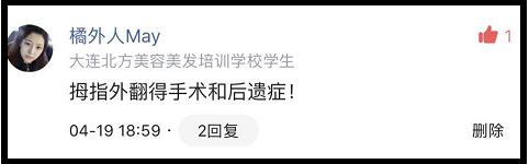 骨刺外翻什么症状,骨刺会导致拇指外翻吗