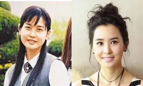 打瘦脸失败的案例,打瘦脸针出事故