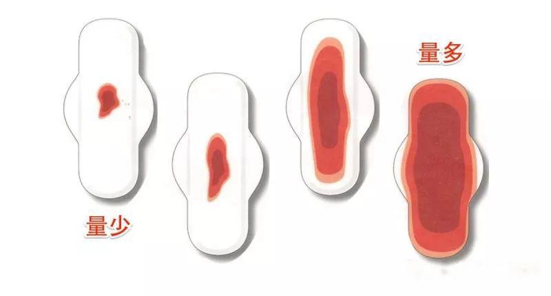 子宫肌瘤导致月经量过大咋办,女人月经量特别大怎么回事