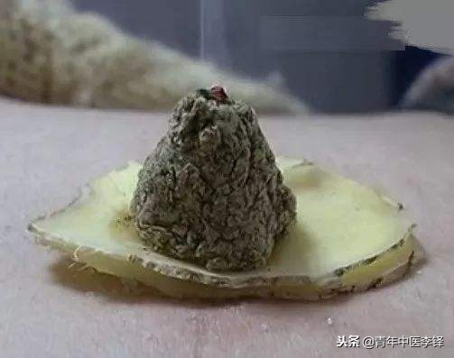 关元穴治阳虚,关元穴的作用和禁忌