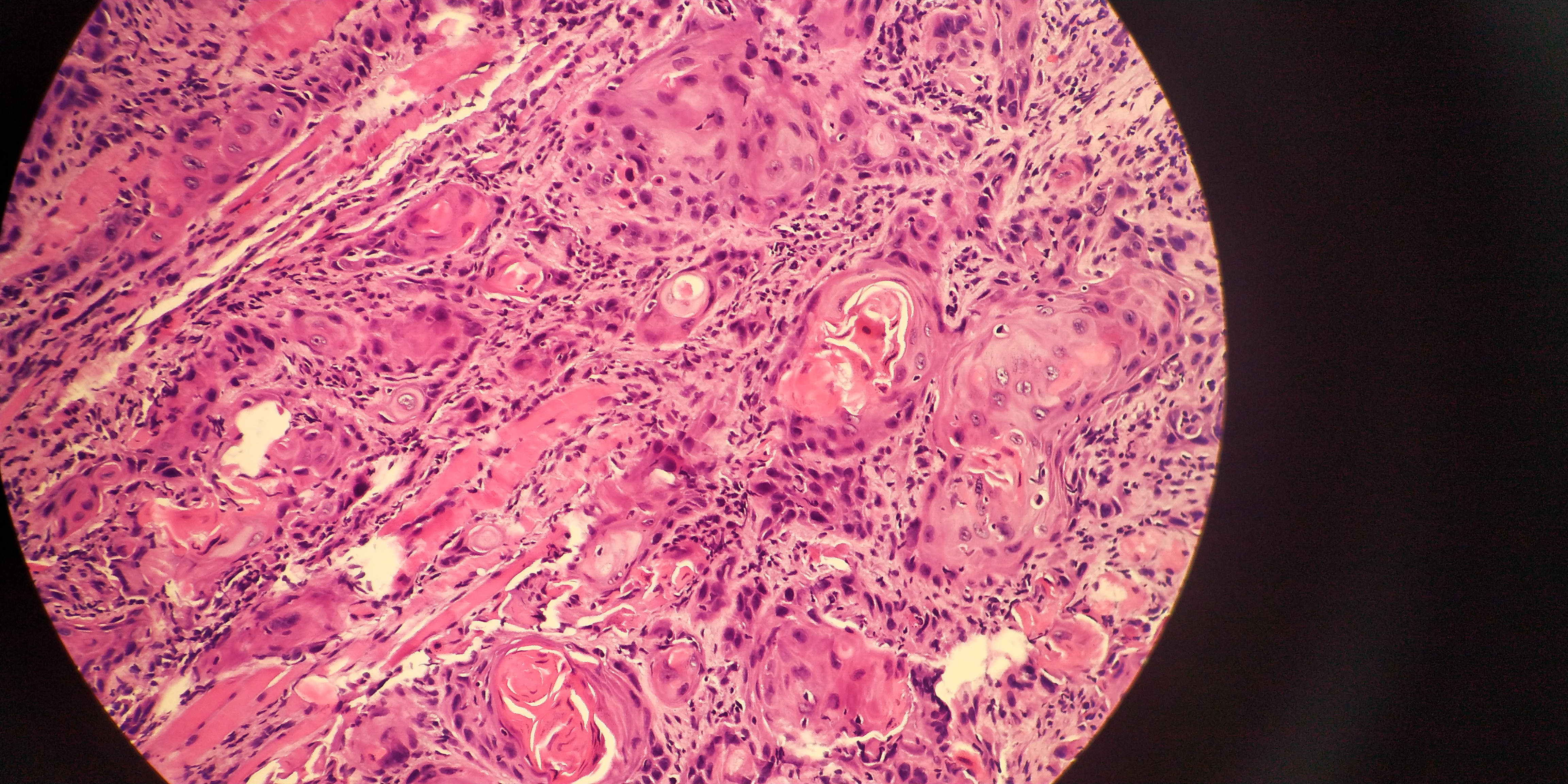 吃槟榔是需要削骨吗,吃槟榔用剥皮吗