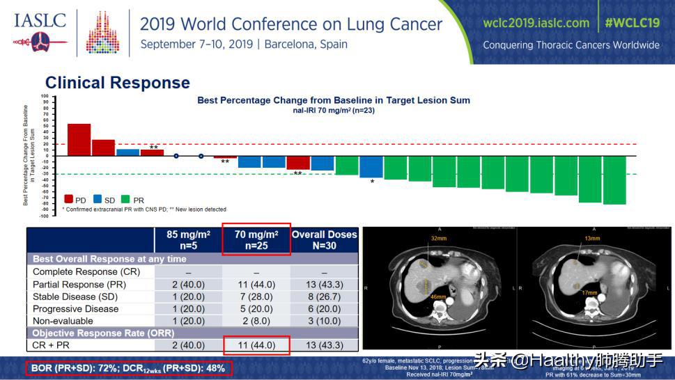 小细胞肺癌有几种药有效,小细胞肺癌用药方案