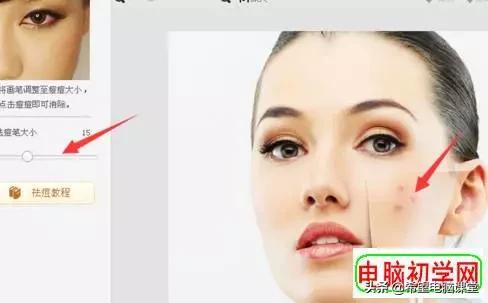 照片上痘痘怎么去除,怎么去除照片上的痘痘