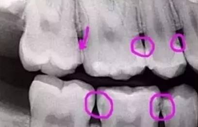 看牙不拍片直接说费用,医院看牙拍片贵吗