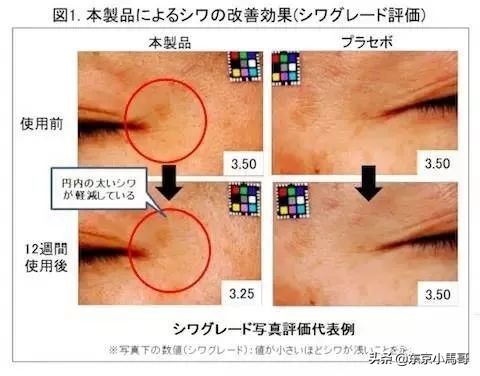 pola抗皱精华能减轻法令纹吗 (pola去皱精华限定套装)