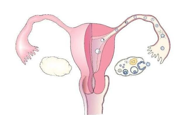 影响试管婴儿成功率的因素,影响试管婴儿成功的因素