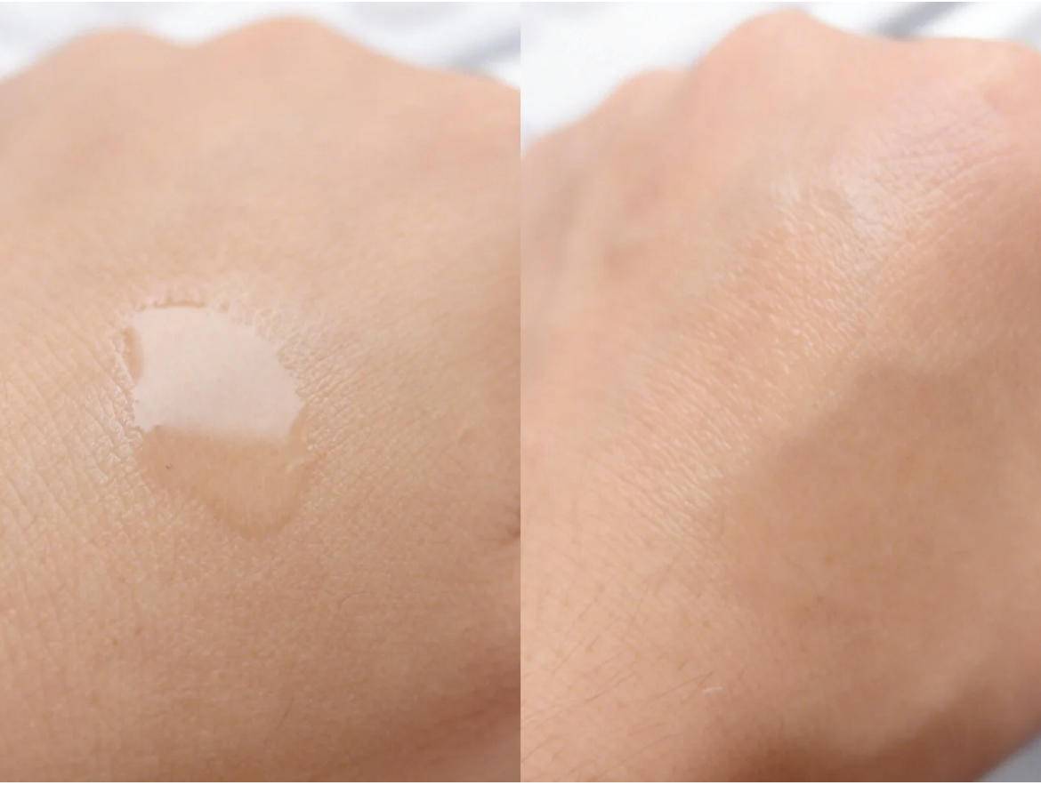 去闭口快速有效的方法,去闭口最有效的方法推荐