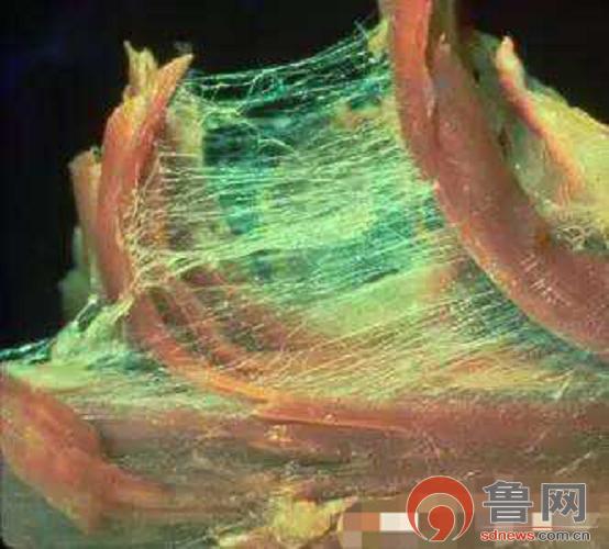 “手麻手胀”是谁惹的祸?*安泰**市中医医院推拿科主治医师秦后伟告诉您答案