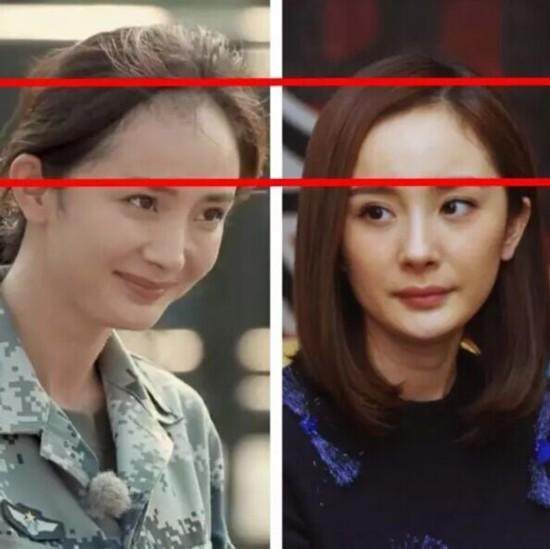 陈奕迅秃顶头发稀疏,陈奕迅同款发际线怎么补救