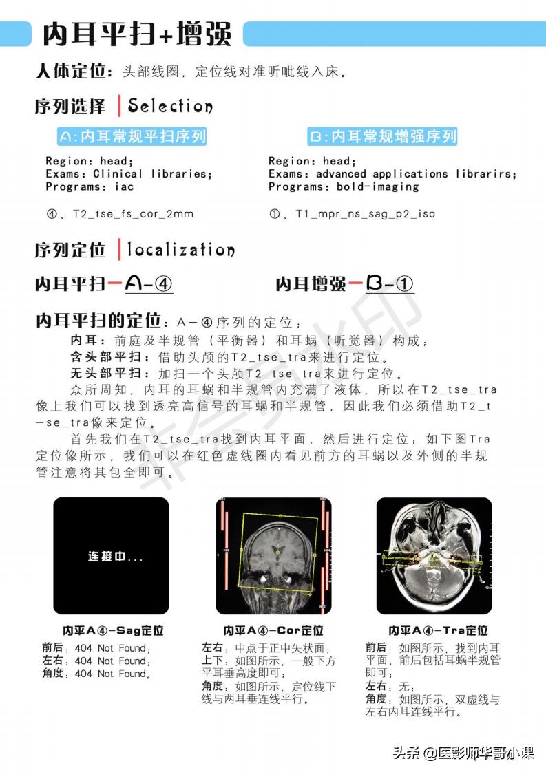 磁共振扫描技术西门子,西门子磁共振最新操作界面