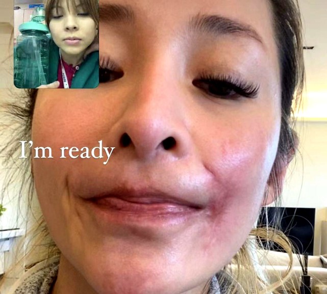 萧亚轩被狗咬伤脸部照片,萧亚轩被狗咬伤脸部怎么修复的