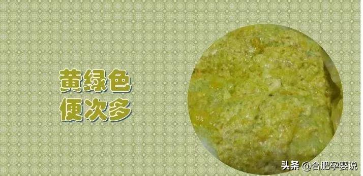 小宝宝拉绿屎怎么了,老话说宝宝拉绿屎怎么说