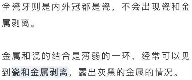 全瓷牙与烤瓷牙价格差多少,全瓷牙和烤瓷牙的价格差多少