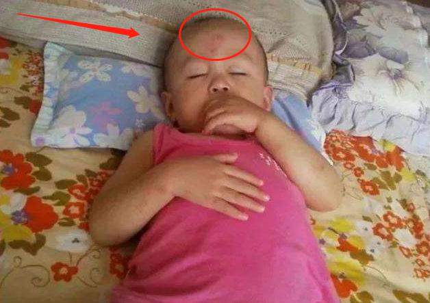 孩子摔伤头部的护理,孩子摔伤家长处理伤口