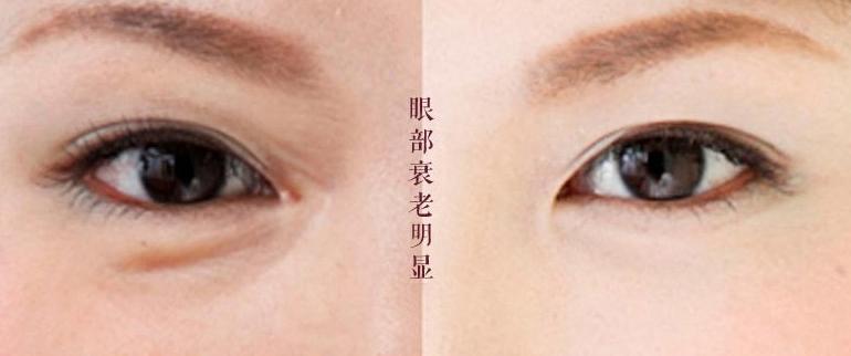 淡化细纹保湿紧致眼霜小棕瓶,媲美雅诗兰黛小棕瓶眼霜