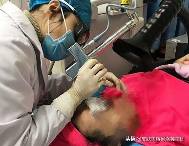 脸上有皱纹最快的去皱方法,脸上的皱纹用什么办法去皱效果好