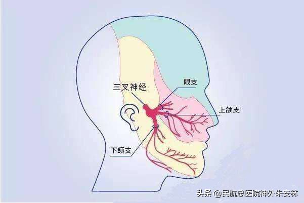 血管压迫三叉神经痛会痛一辈子吗,原发与继发三叉神经痛如何治疗