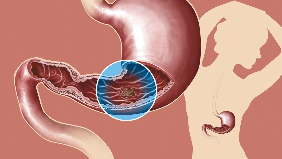 中午吃饱了就犯困要不要睡,为什么中午吃饱睡觉醒了很难受