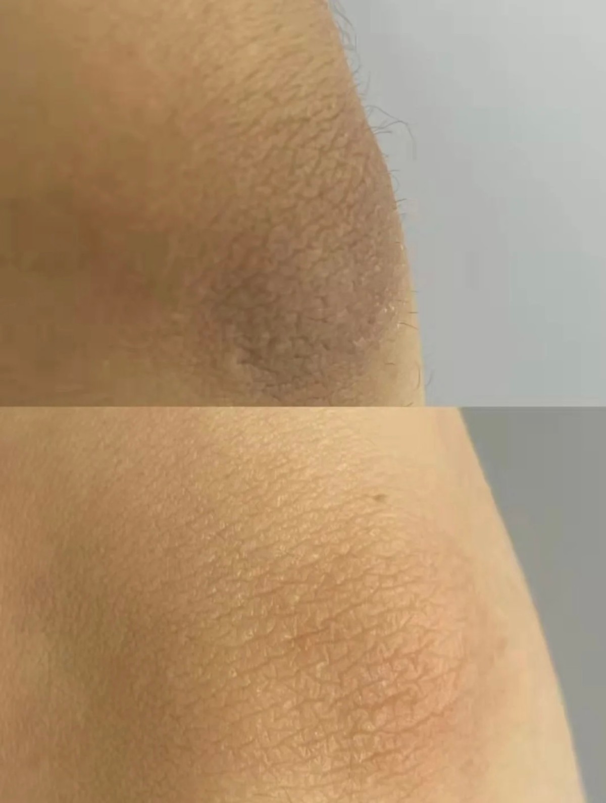 磨砂膏推荐美白去鸡皮和死皮,磨砂膏测评红黑榜去鸡皮平价